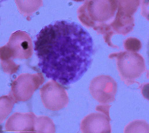 basophil