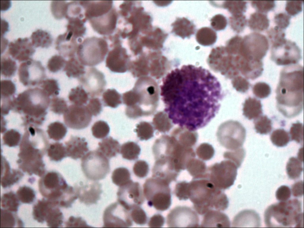 basophil