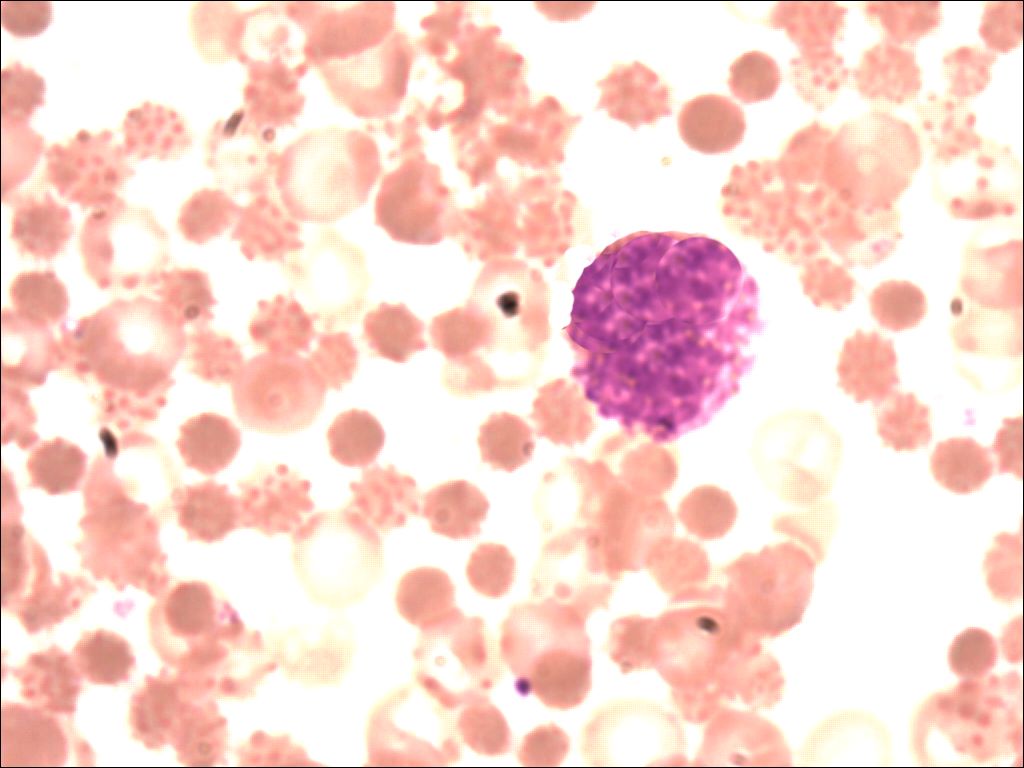 basophil