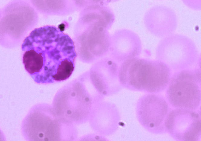 basophil