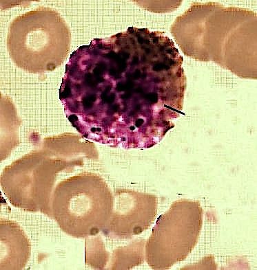 basophil