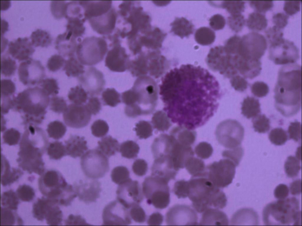 basophil