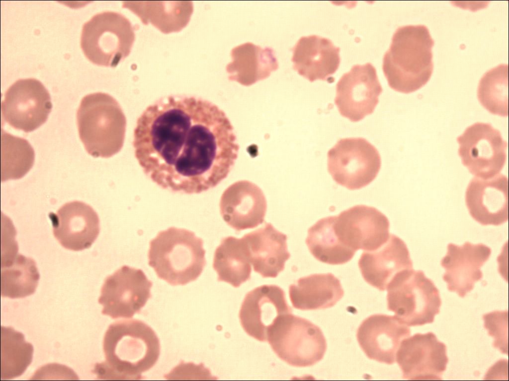 eosinophil