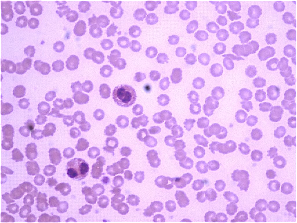 eosinophil