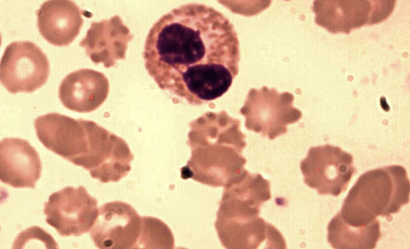 eosinophil