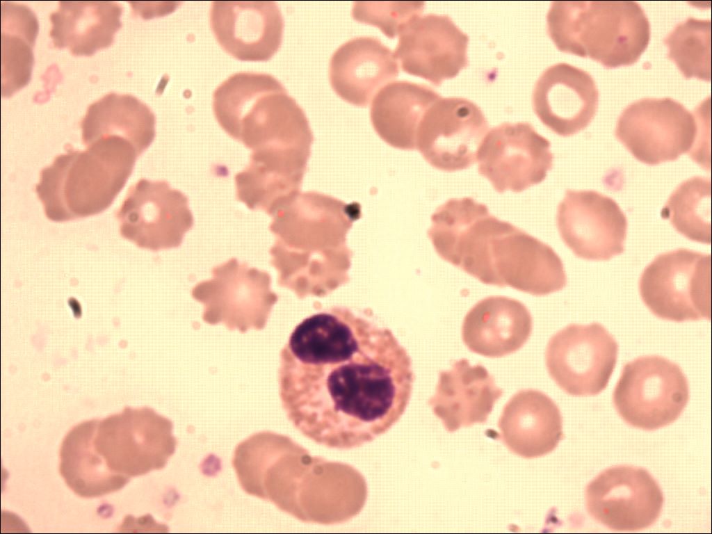 eosinophil