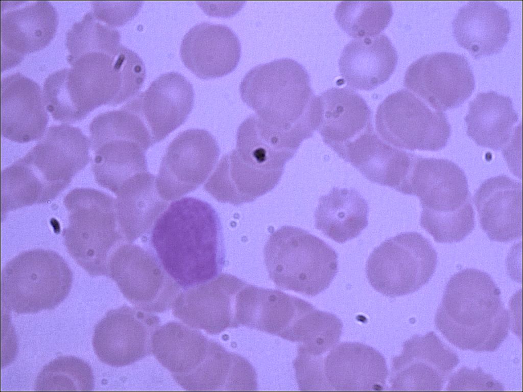 lymphocytel