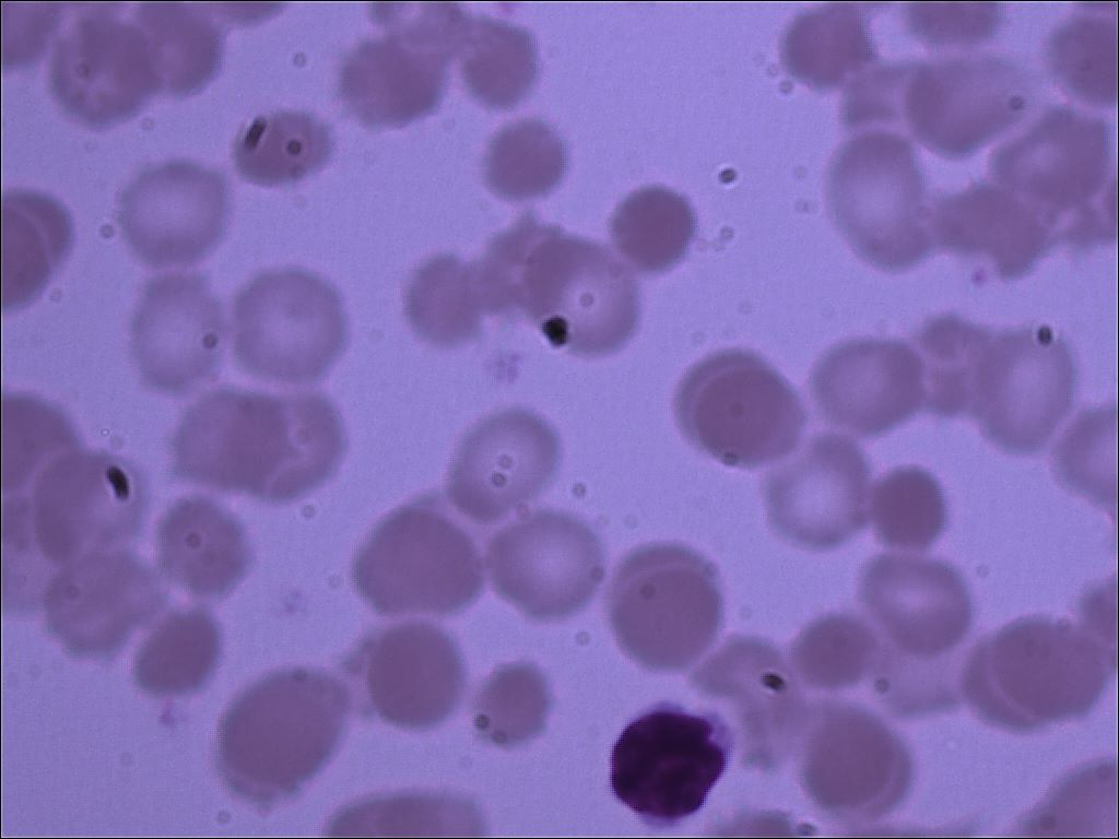 lymphocytel