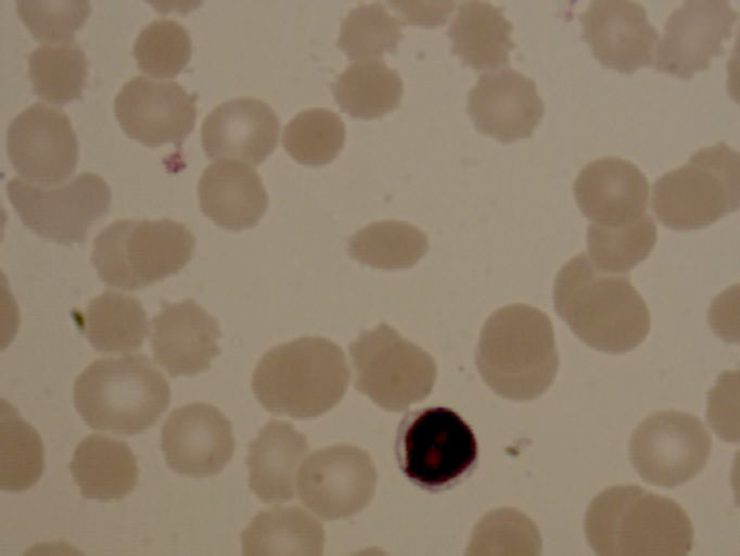 lymphocytel