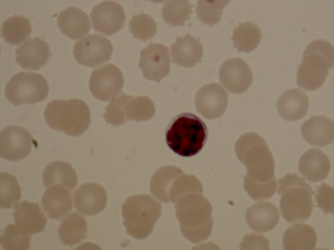 lymphocytel