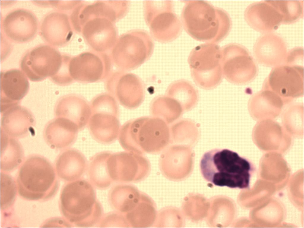 lymphocytel