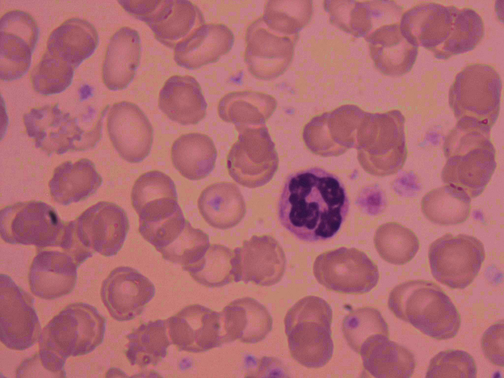 neutrophil