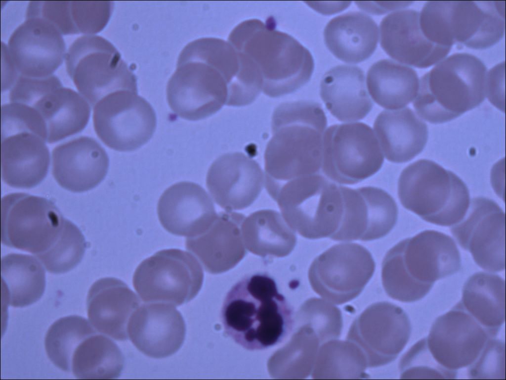 neutrophil