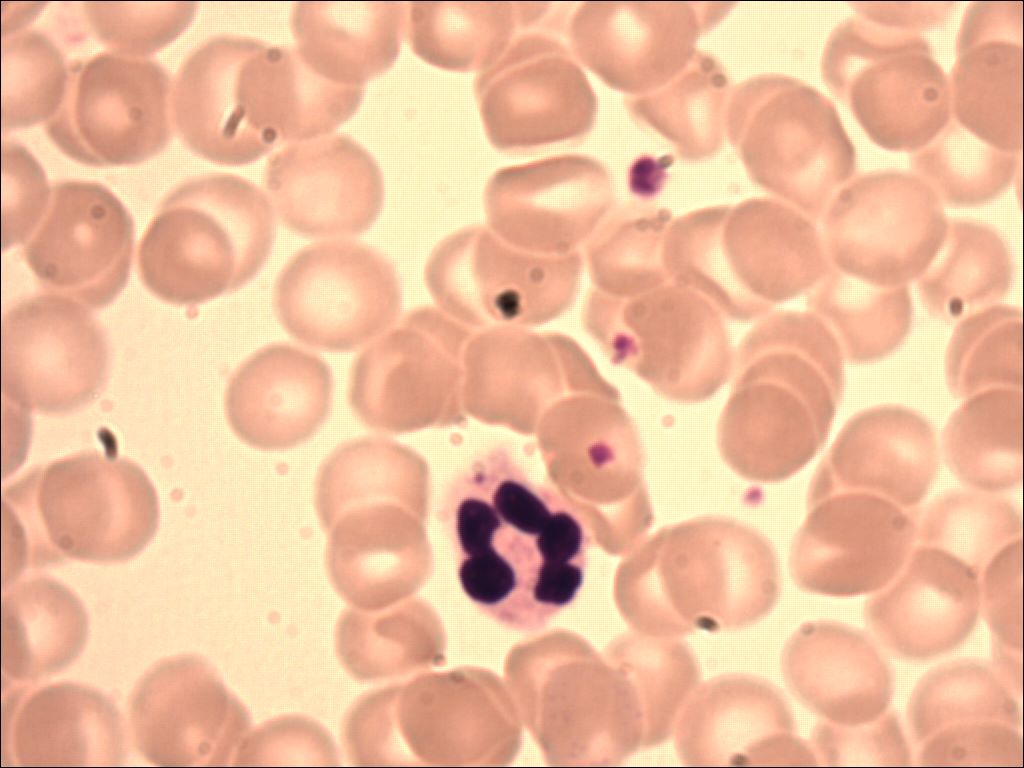 neutrophil