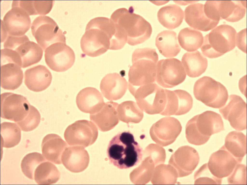 neutrophil