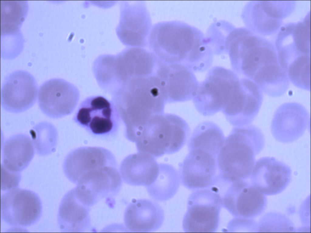 neutrophil