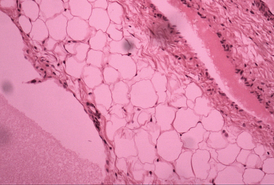 adipose connective tissue