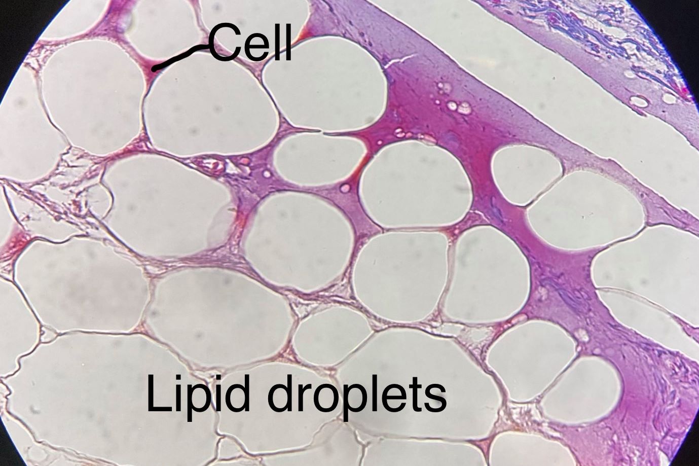 adipose connective tissue