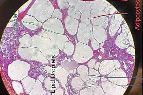 adipose connective tissue