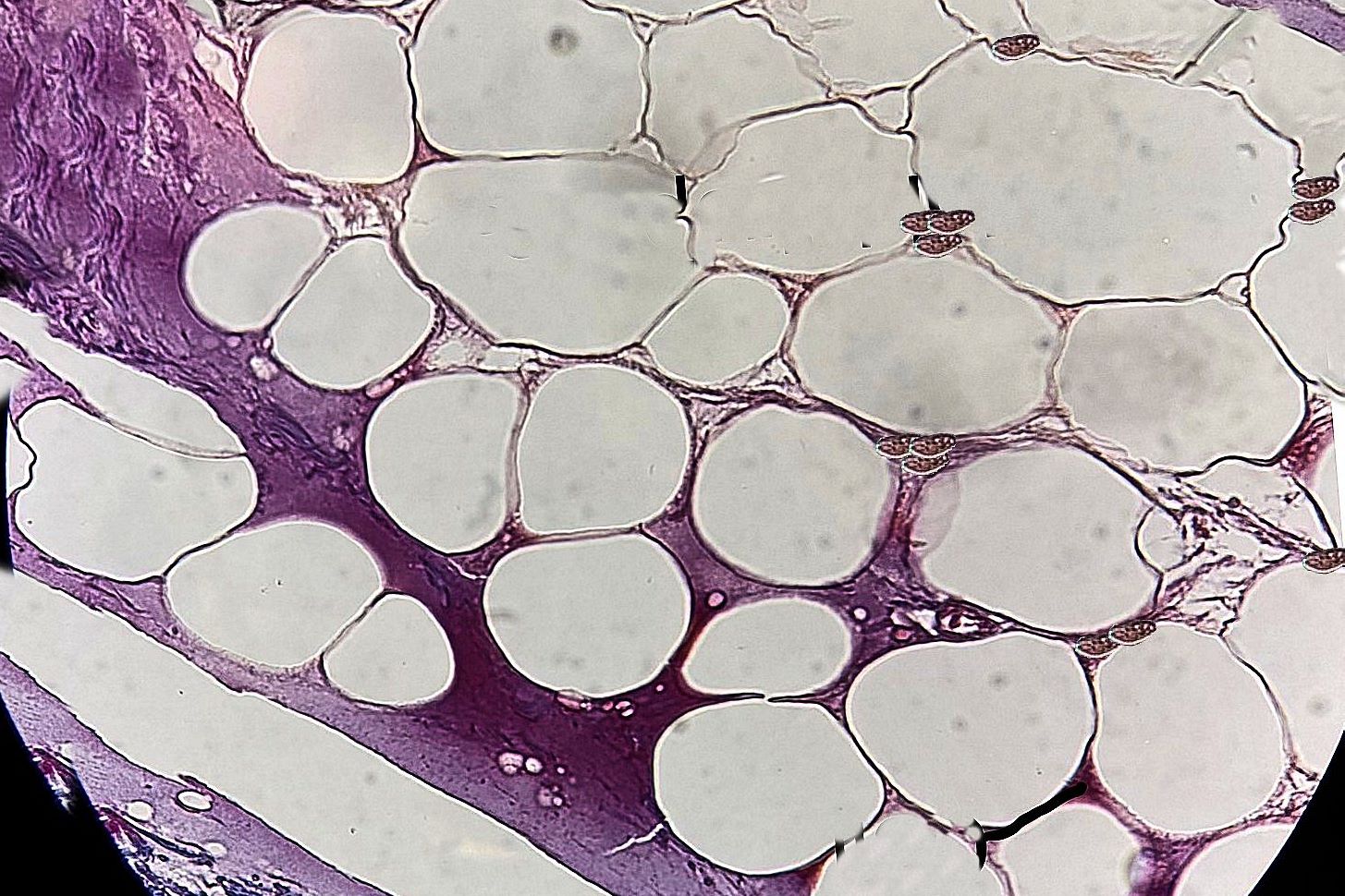 adipose connective tissue