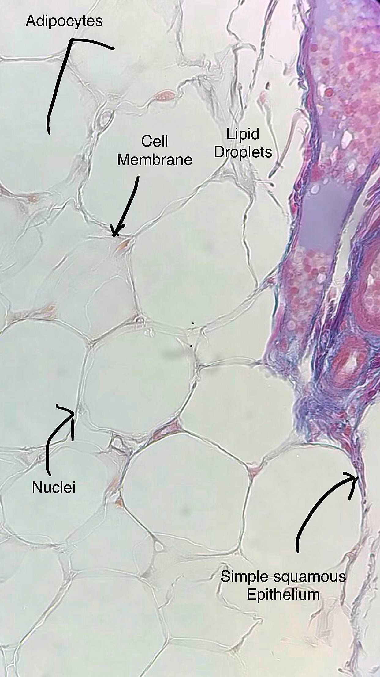 adipose connective tissue