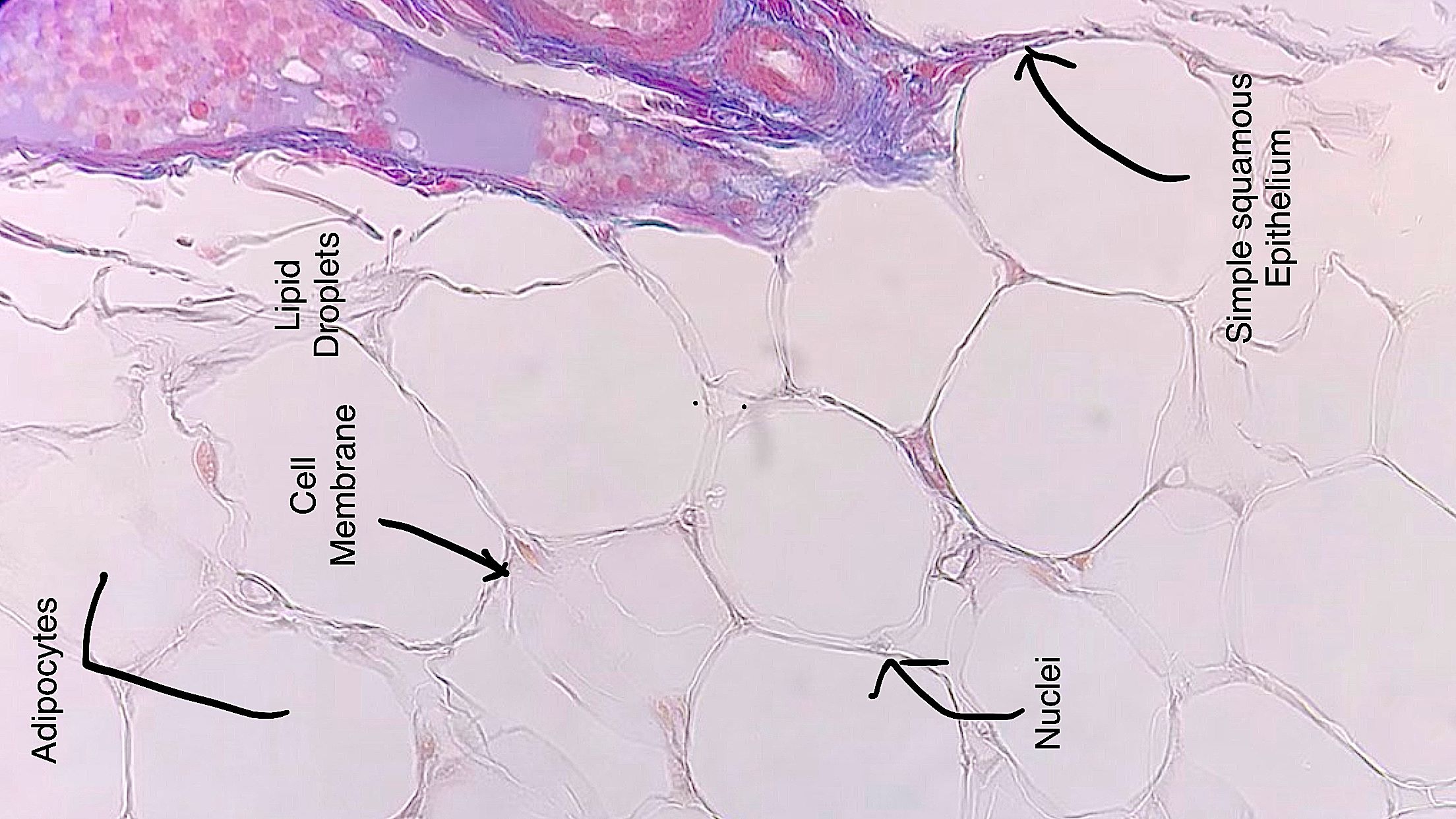 adipose connective tissue