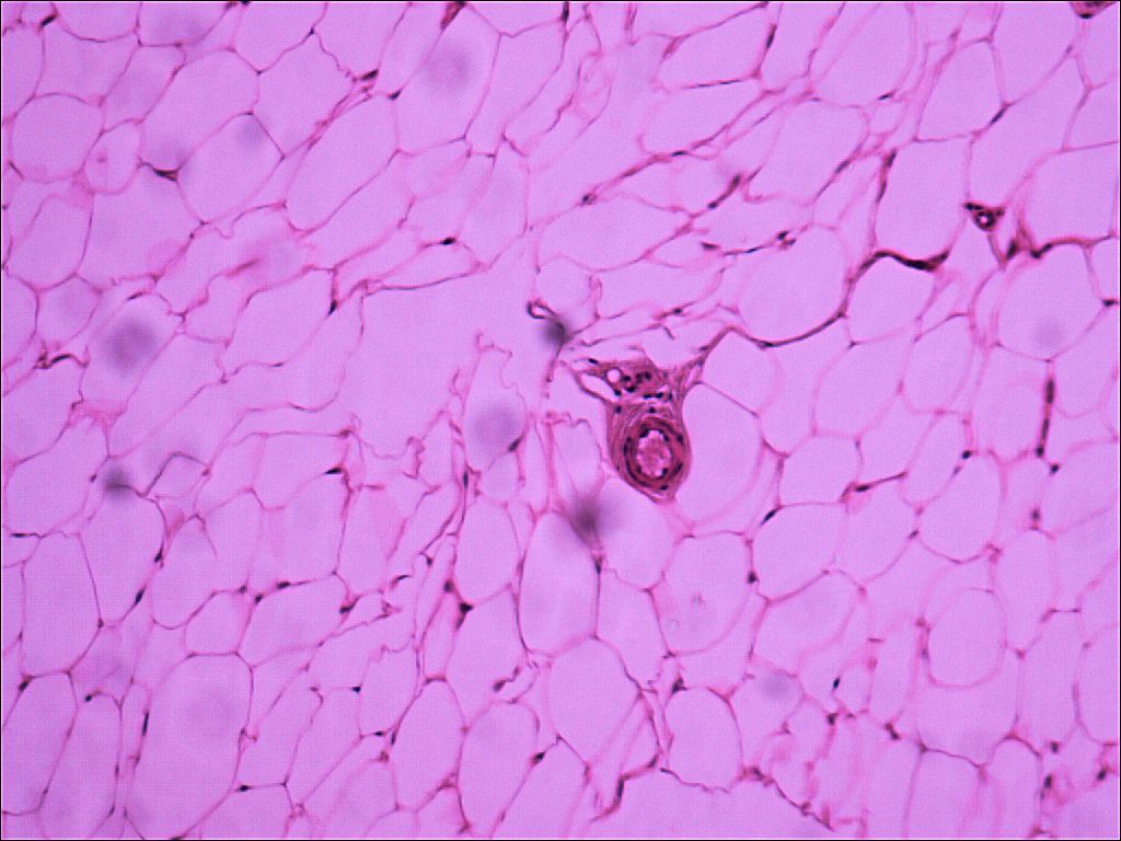 adipose connective tissue