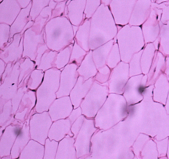 adipose connective tissue