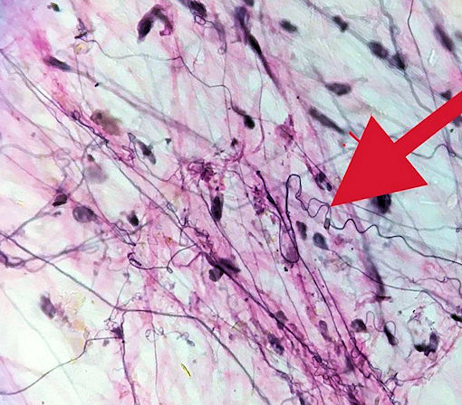 areolar connective tissue