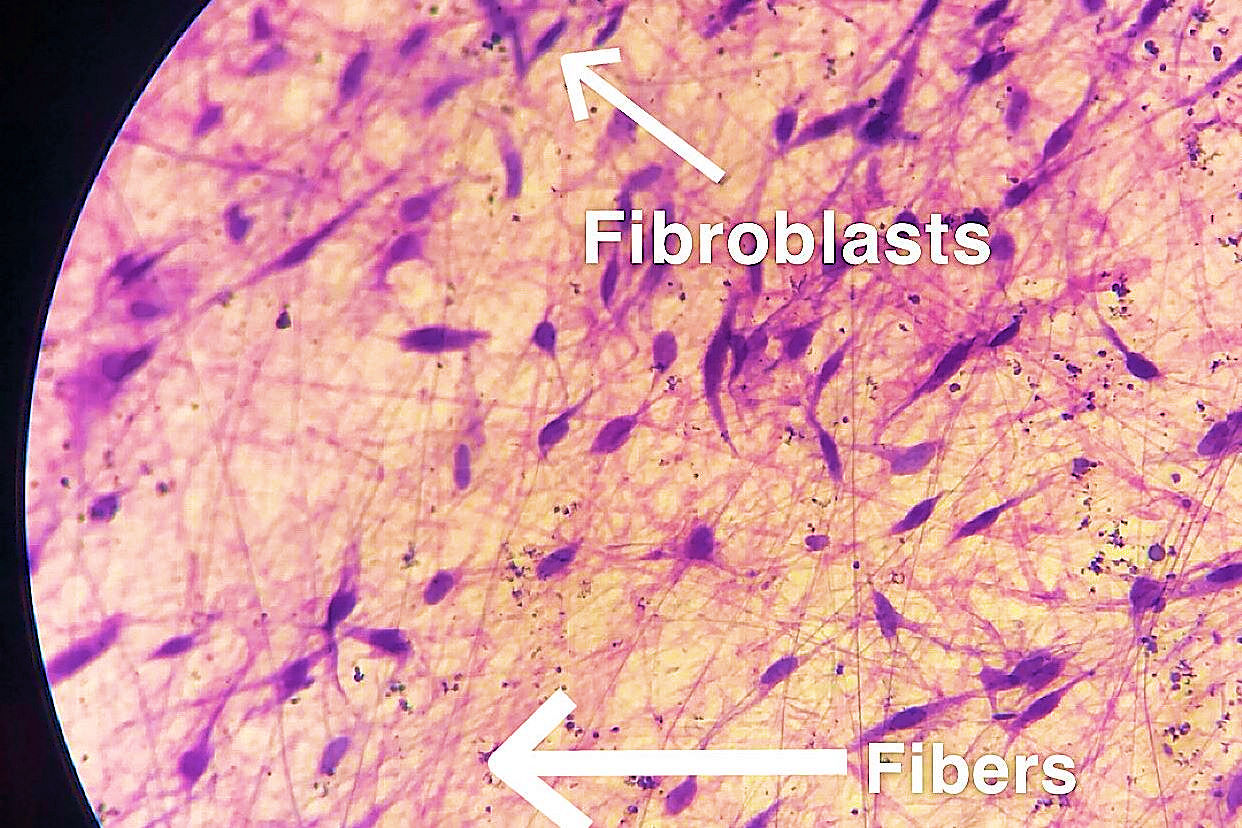 areolar connective tissue