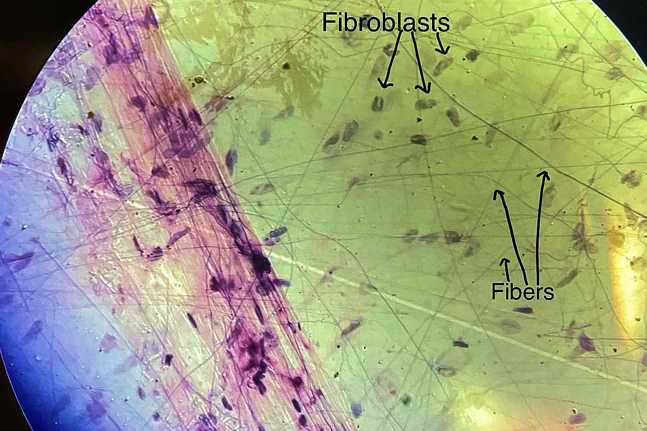 areolar connective tissue