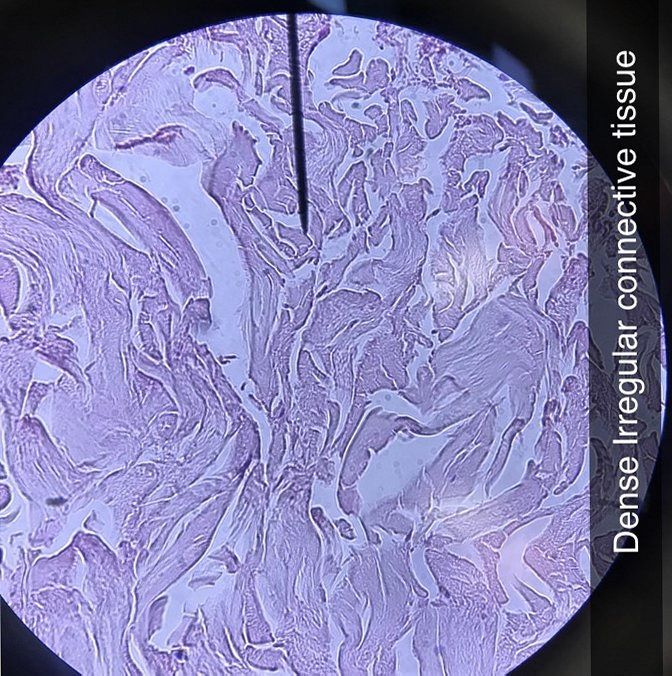 Dense Irregular connective tissue