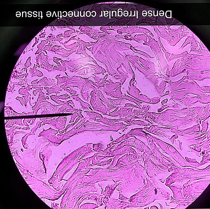 Dense Irregular connective tissue