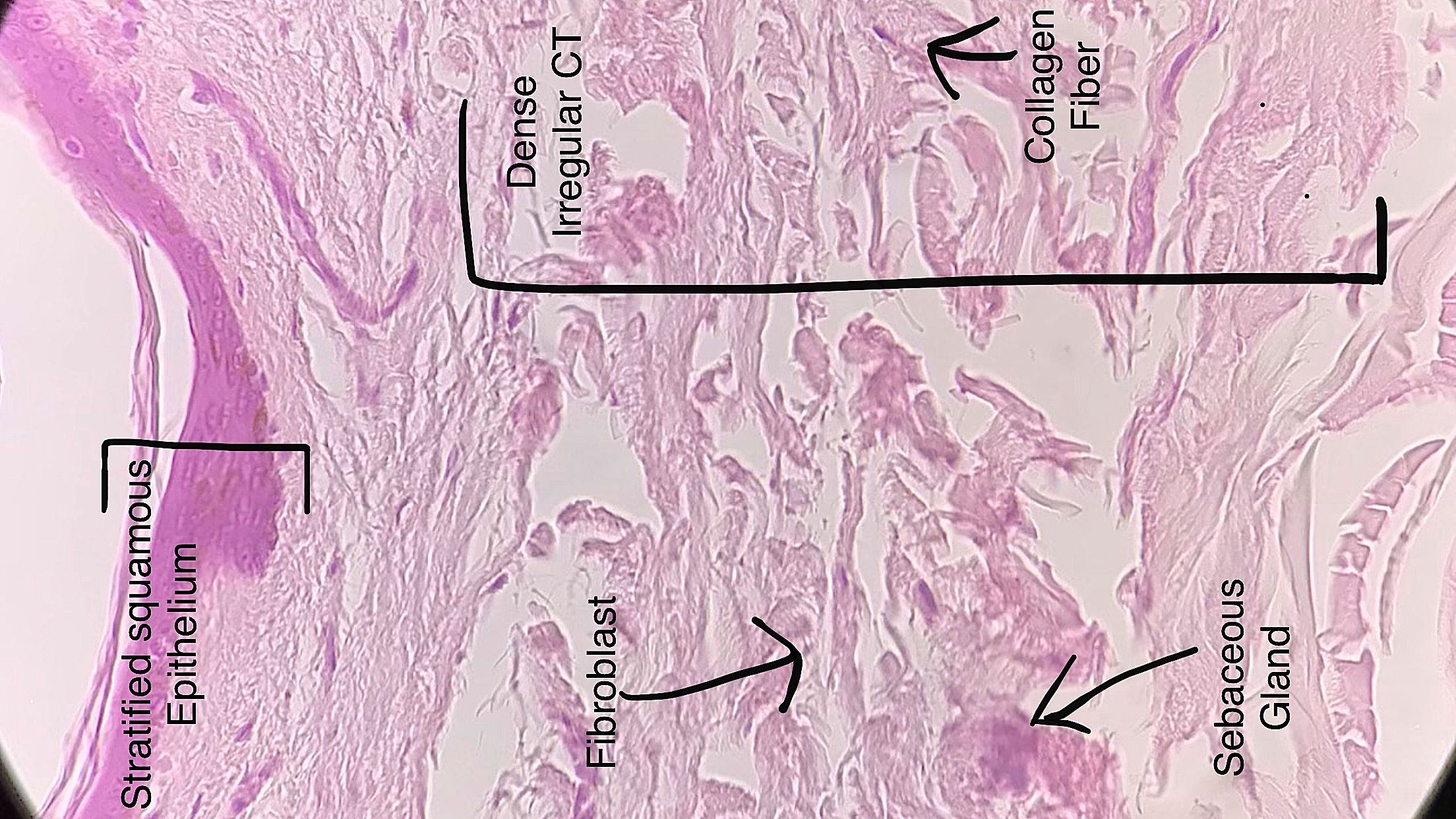 Dense Irregular connective tissue