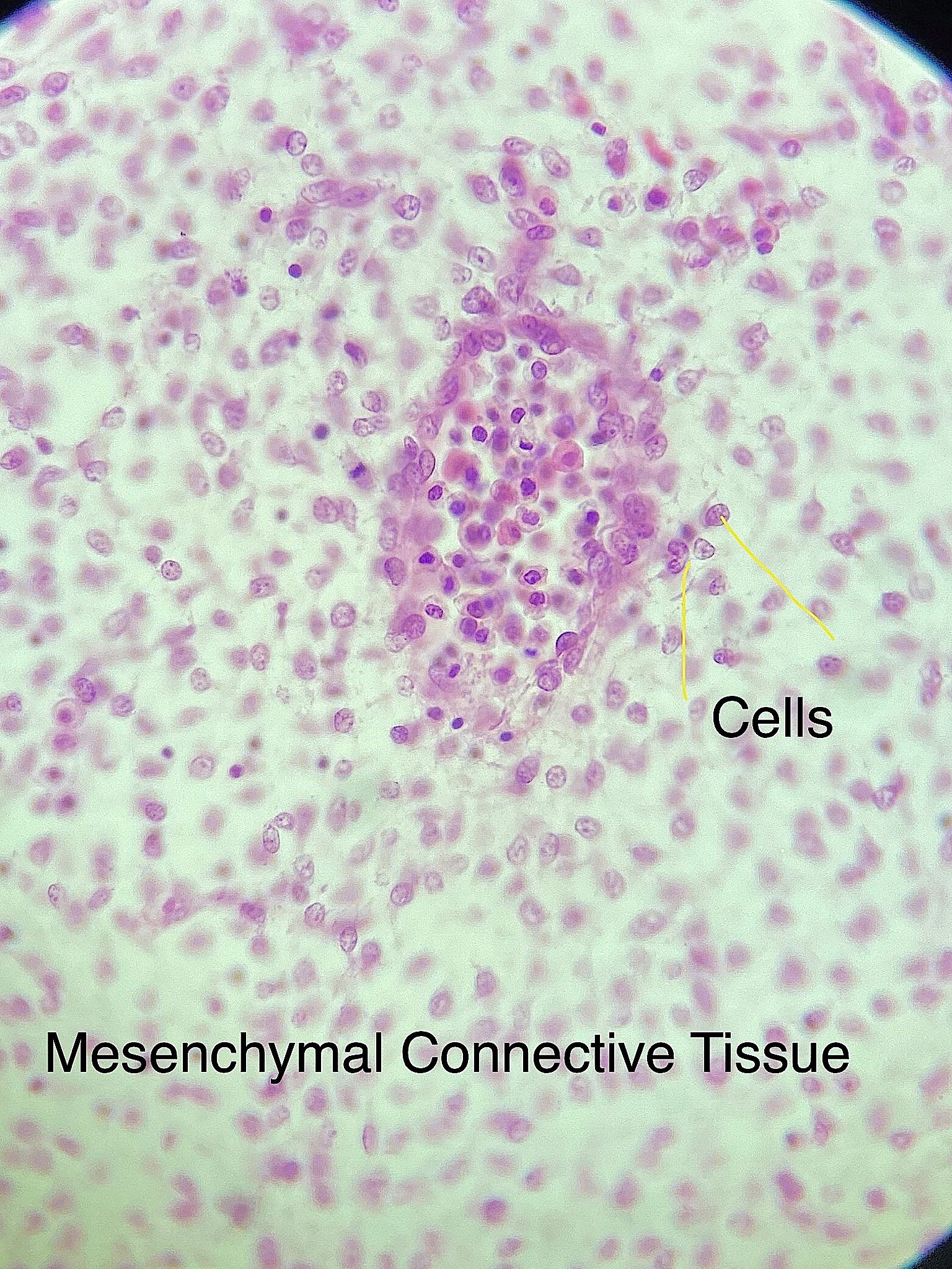 mesenchyme connective tissue