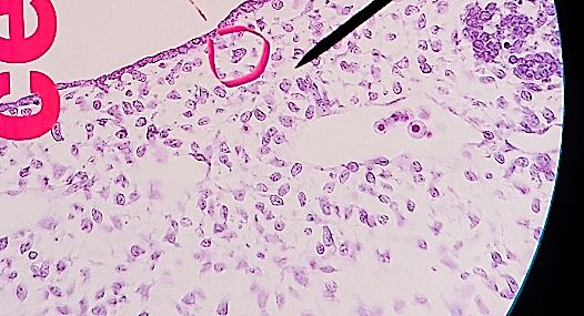 mesenchyme connective tissue