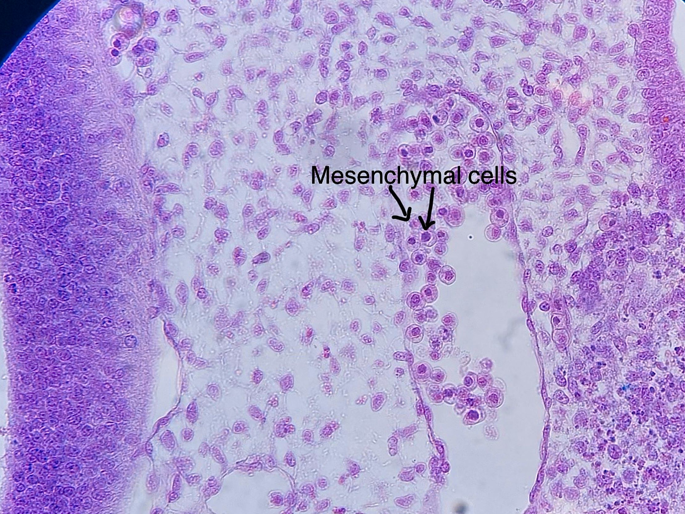 mesenchyme connective tissue