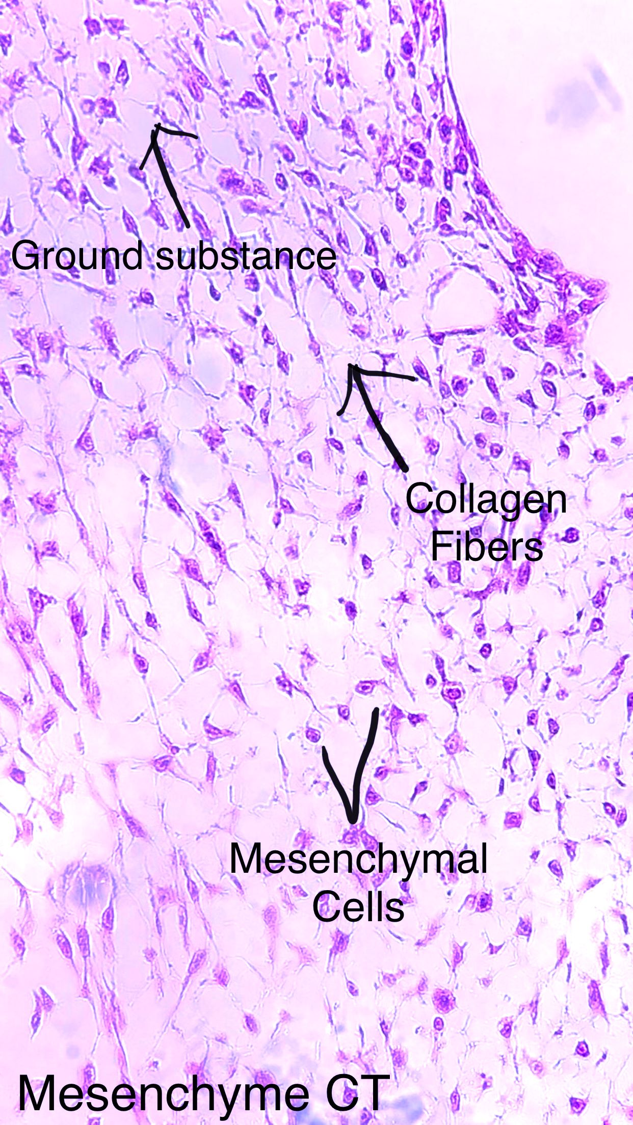 mesenchyme connective tissue