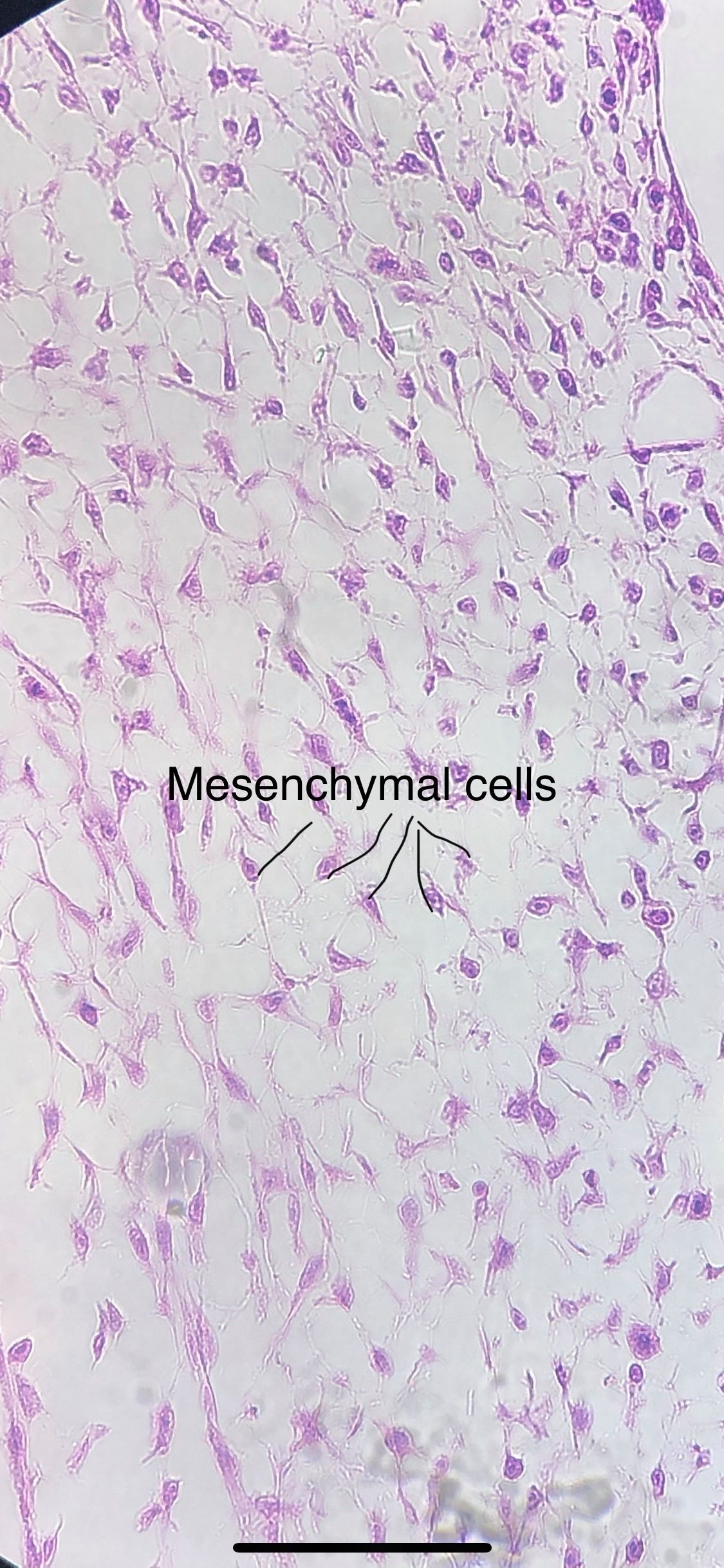 mesenchyme connective tissue