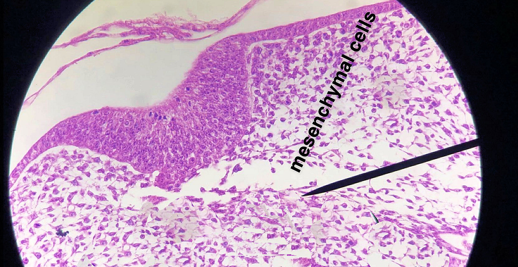 mesenchyme connective tissue