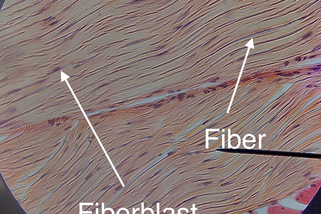 dense regular connective tissue