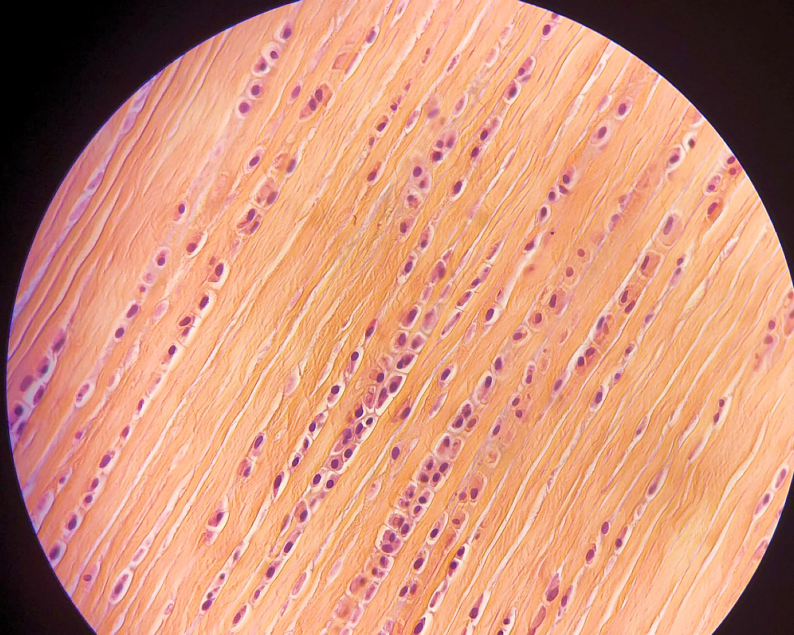 dense regular connective tissue