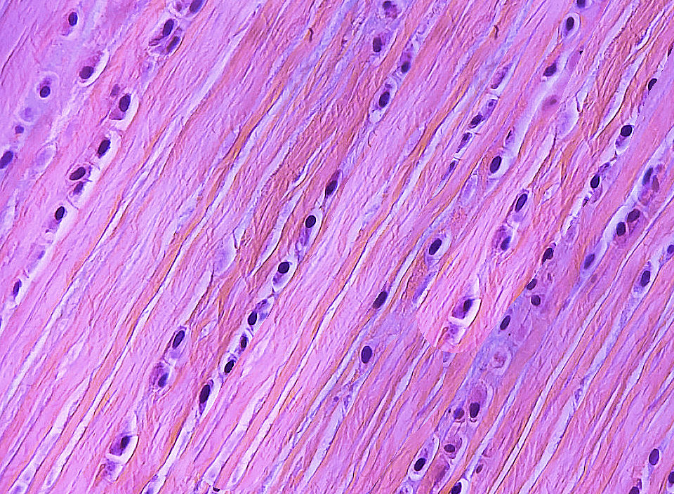 dense regular connective tissue