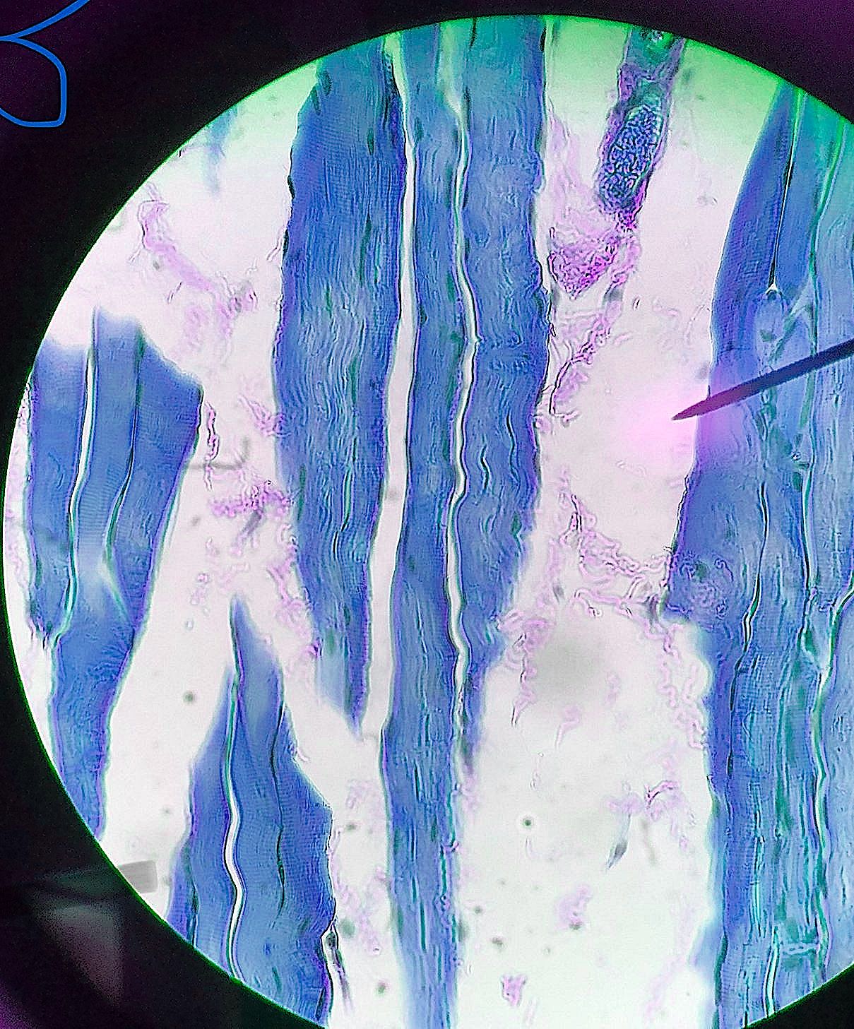 dense regular connective tissue