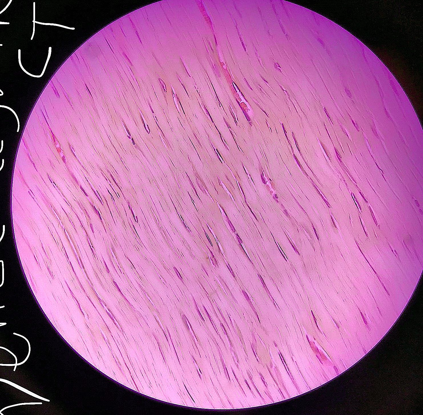 dense regular connective tissue