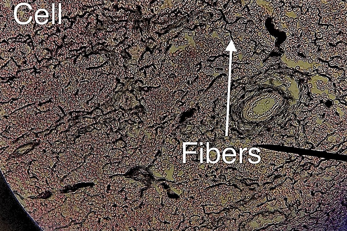 reticularconnective tissue