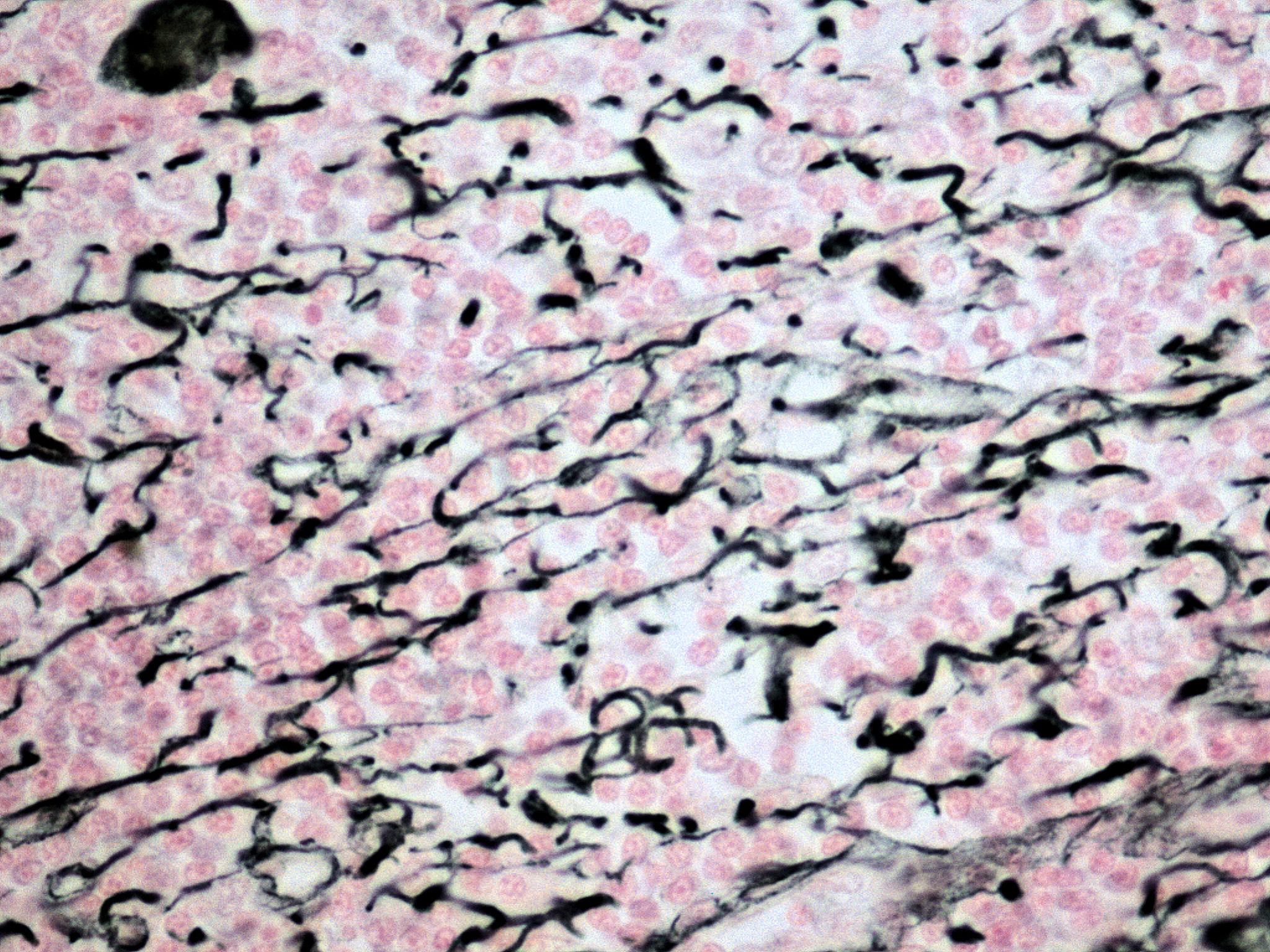 reticularconnective tissue