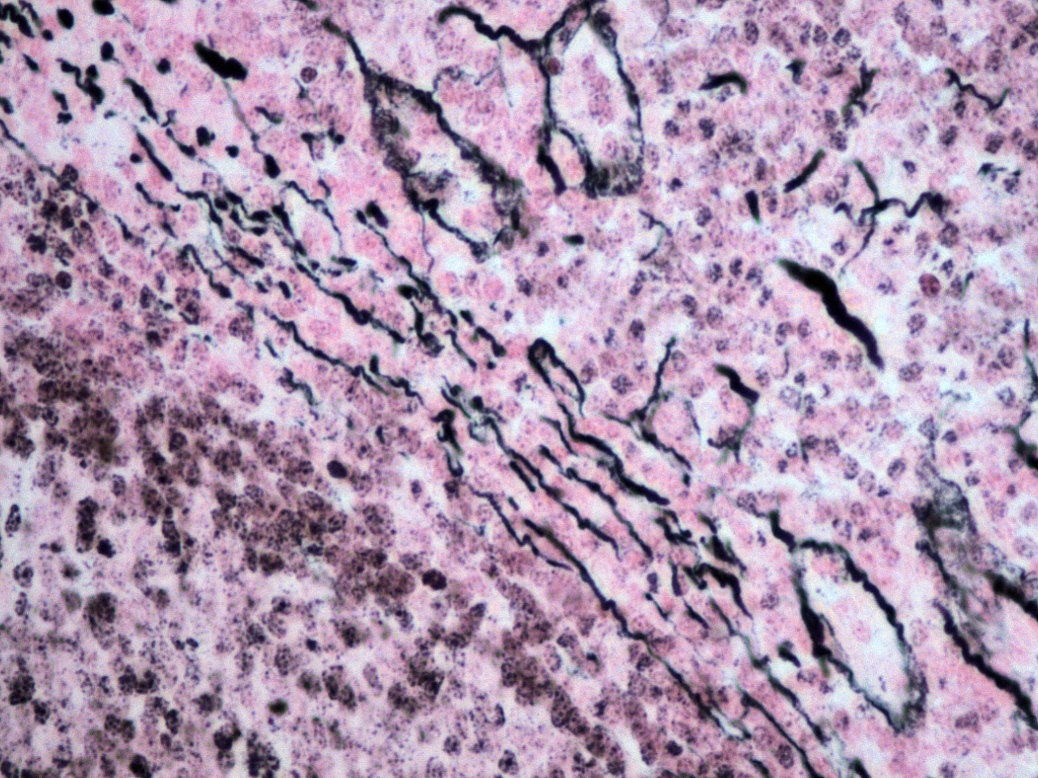 reticularconnective tissue