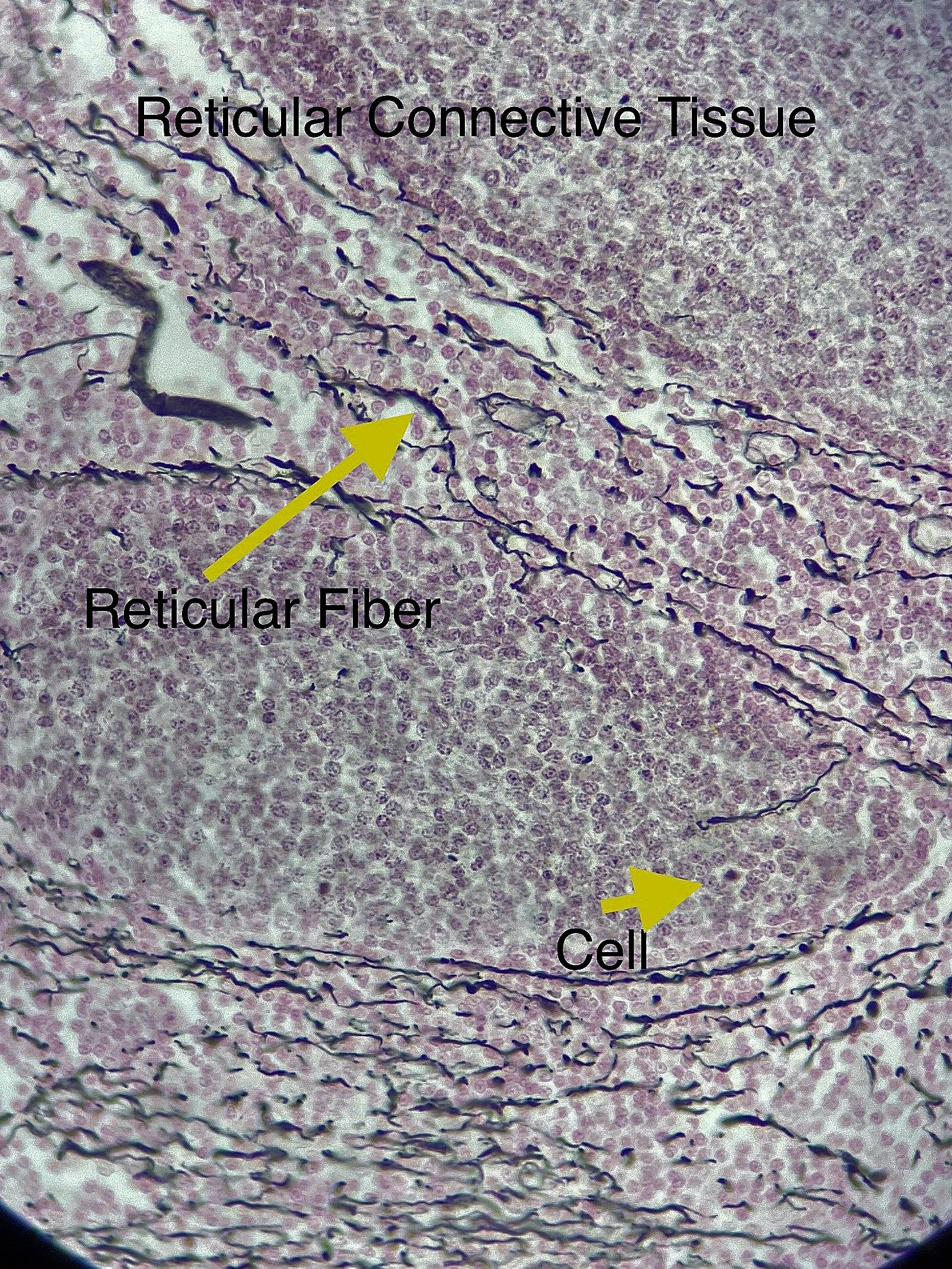 reticularconnective tissue