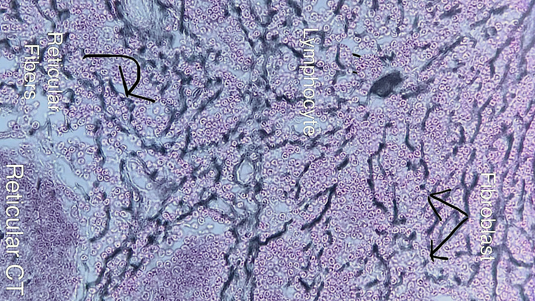 reticularconnective tissue